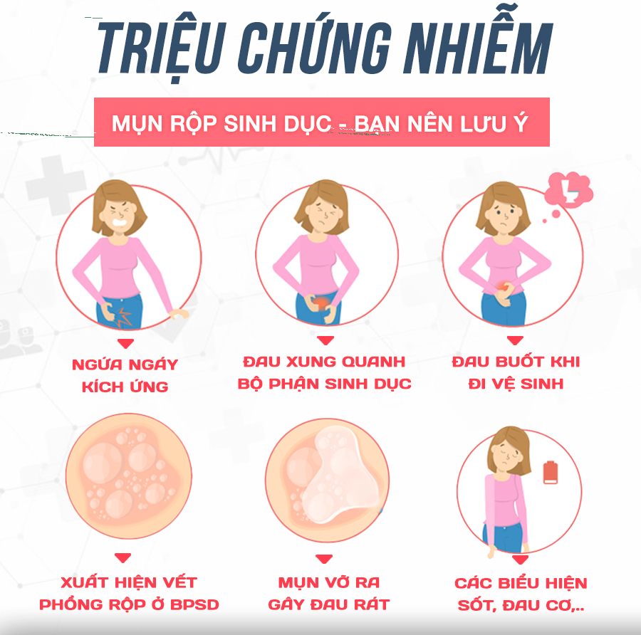 Dấu hiệu mụn rộp sinh dục ở nữ giới