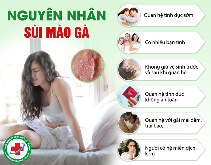 Nguyên nhân gây sùi mào gà ở nữ giới
