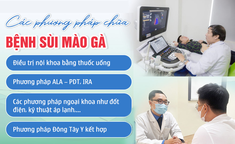 Phương pháp hỗ trợ điều trị sùi mào gà
